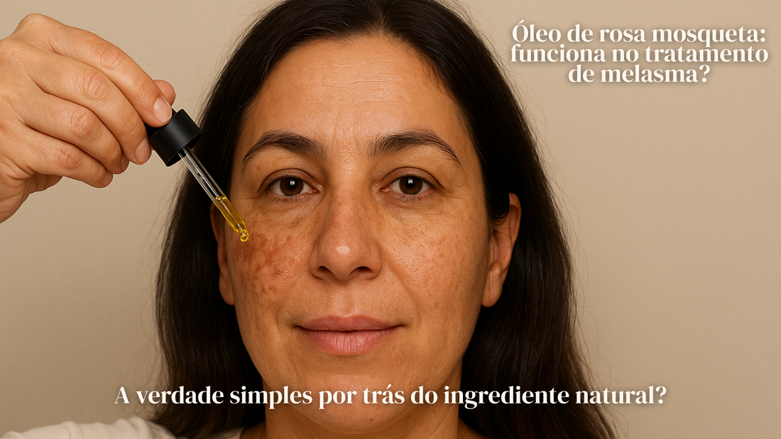 Óleo de Rosa Mosqueta: Funciona no Tratamento de Melasma?