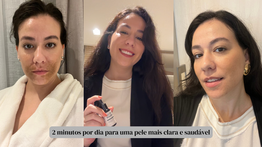 Rotina de Skincare Ideal para Quem Tem Melasma